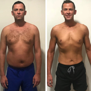 Antes e Depois - 04
